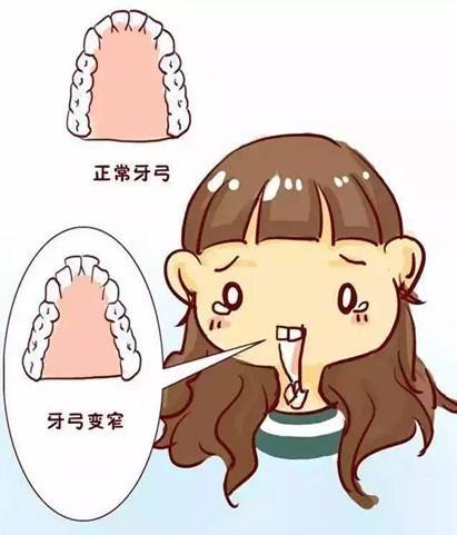 牙齒矯正