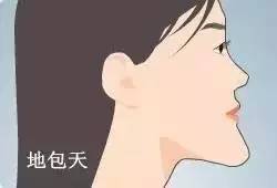 地包天手術風險大嗎